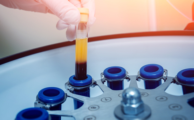 Blood centrifuge plasma